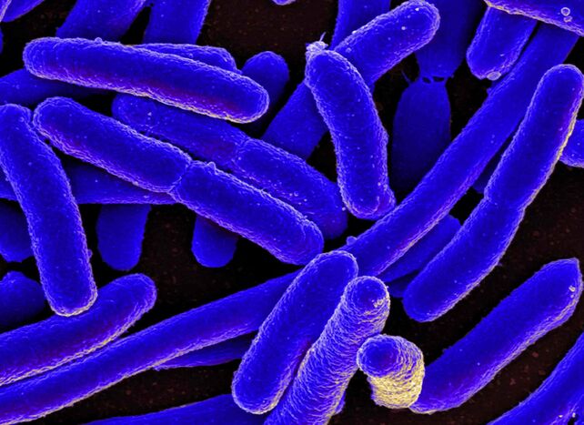E. coli visbiežāk provocē cistīta attīstību sievietēm